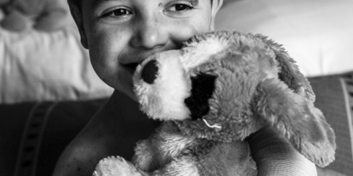 Young boy with EB