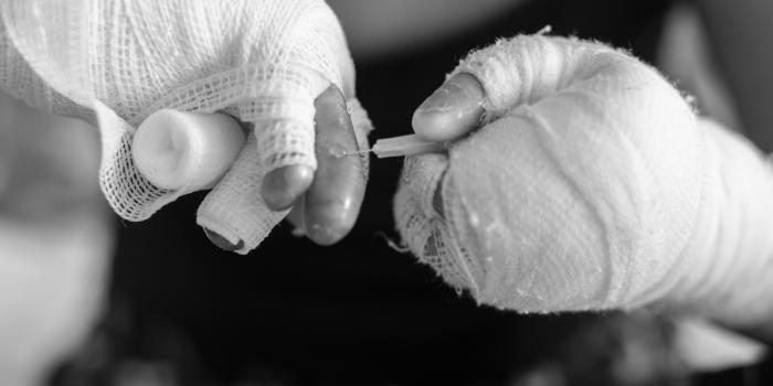 Hand and EB