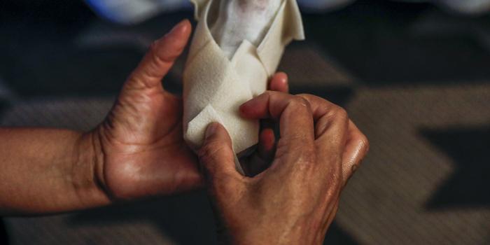 Epidermolysis Bullosa Foot Care
